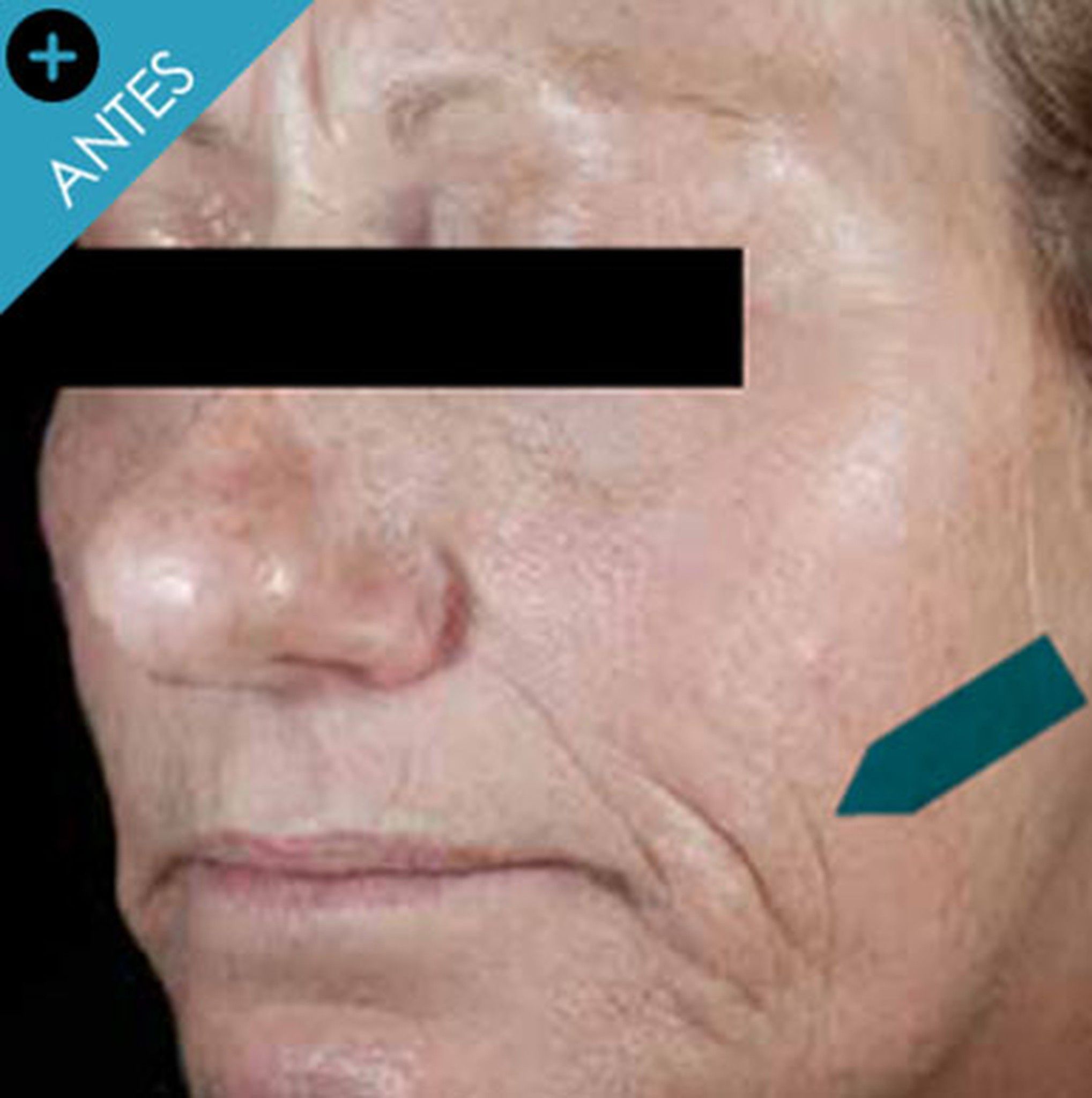 skin7