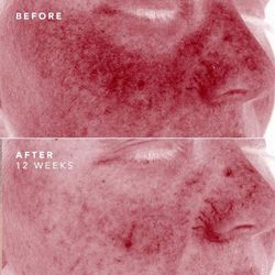 Bioeffect Egf + 2a Daily Duo