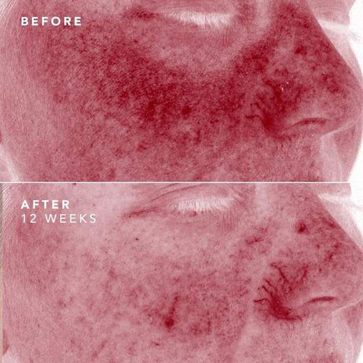 Bioeffect Egf + 2a Daily Duo