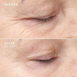 Bioeffect Egf 30 Tage Behandlungsserum 3 X 5 ml