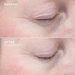 Bioeffect Augenserum 6 ml