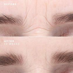 Bioeffect Power Duo (Egf Augenserum 6 ml + Egf Serum 15 ml)