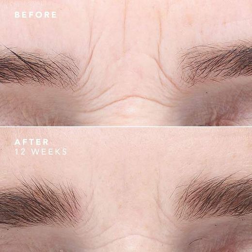 Bioeffect Power Duo (Egf Augenserum 6 ml + Egf Serum 15 ml)