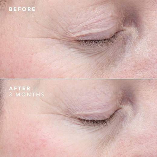 Bioeffect Power Duo (Egf Augenserum 6 ml + Egf Serum 15 ml)