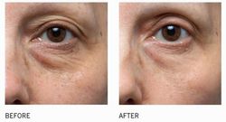 Is Clinical C Eye Serum Advance + 15 Ml