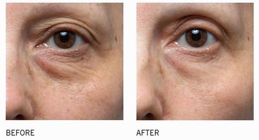 Is Clinical C Eye Serum Advance + 15 Ml