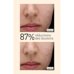 Embryolisse Anti Imperfection Serum 30 ml