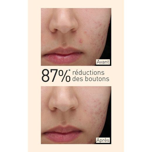 Embryolisse Anti Imperfection Serum 30 ml