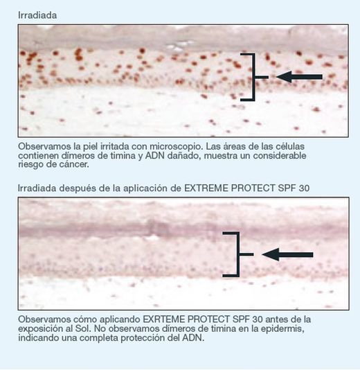 Ist Clinical Extreme Protect Spf 30 100 G
