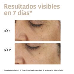 Iroha Nature Mascarilla Antimanchas Ácido Tranexámico