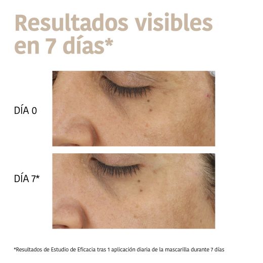 Iroha Nature Mascarilla Antimanchas Ácido Tranexámico