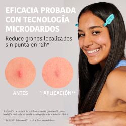 Iroha Nature Parches Granos Microdardos con Ácido Salicílico 12 unidades