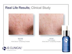 È Siero Attivo Clinico 30 Ml