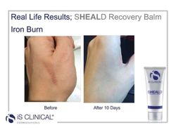 Is Clinical Sheald Recovery Balsamo 60 Ml