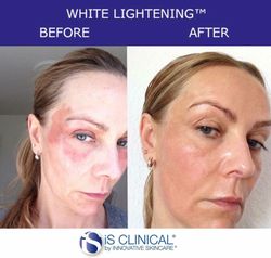 Ist Clinical White Lightening Serum 15ML