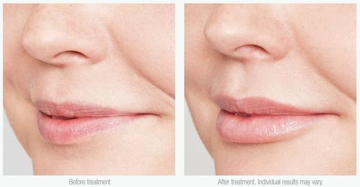 Is Clinical Lip Duo (Lip Polish + Youth Lip Elixir)