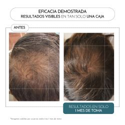 Luxmetique Hair Formula 60 cápsulas