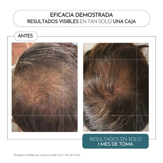 Luxmetique Hair Formula 60 cápsulas