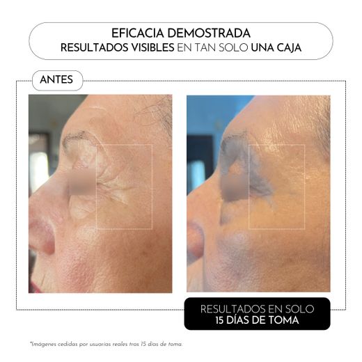 Luxmetique Proage Day Formula 15 viales bebibles