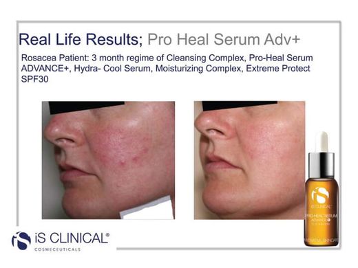 Is Clinical Pro-Heal Serum Advance + 15 Ml