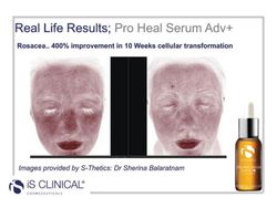 Is Clinical Pro-Heal Serum Advance + 30 Ml