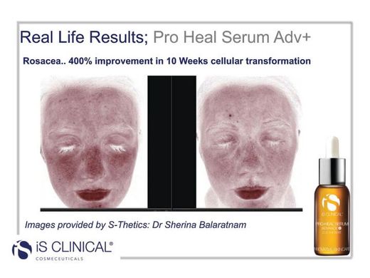 Is Clinical Pro-Heal Serum Advance + 30 Ml