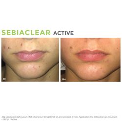Svr Sebiaclear Active 40ml