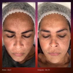 Primaderm Radiant Dual Serum 30 ml