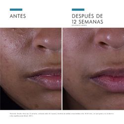 SkinCeuticals Silymarin 30 ml