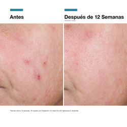 Skinceuticals Advanced RGN-6 50ml
