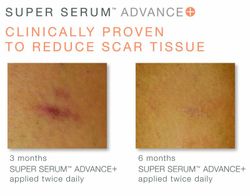 È Clinical Super Serum Advance + 30 Ml