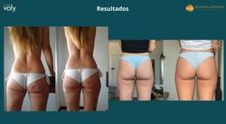 Valy Ion Patch Reducer 56 Parches Anticelulítico