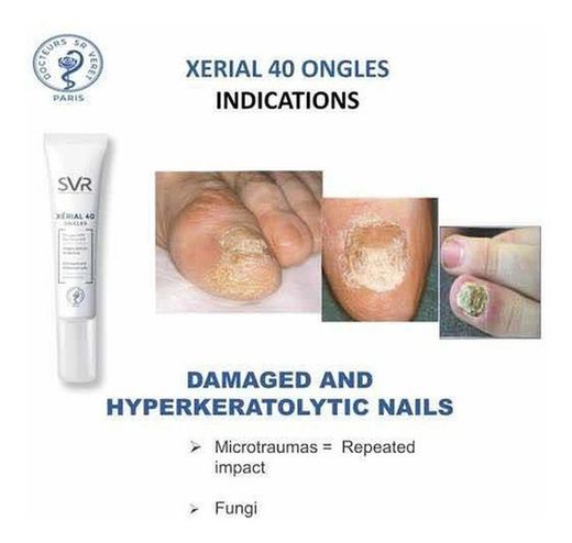 Svr Xerial 40 Ongles 10ml