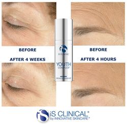 Is Clinical Youth Eye Complex 15 G
