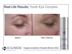 Is Clinical Youth Eye Complex 15 G