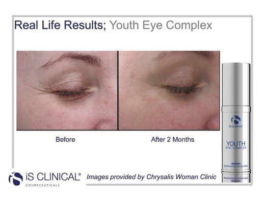 Is Clinical Youth Eye Complex 15 G